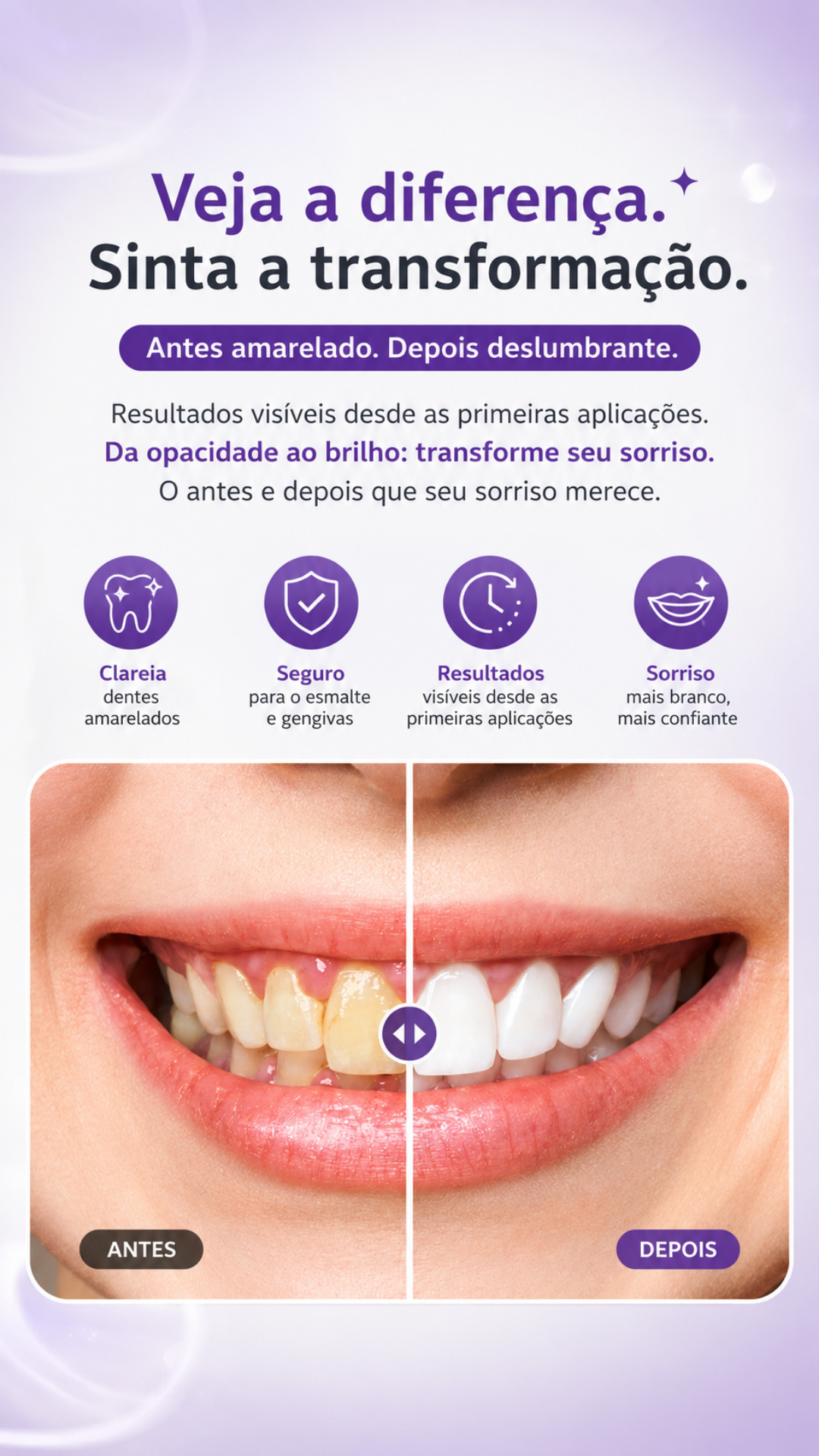 Kit Clareador Dental Whiteness Simple FGM com 2 Seringas + Dessensibilizante +  Moldeira 2